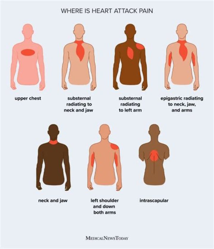 When should I be concerned about arm pain?