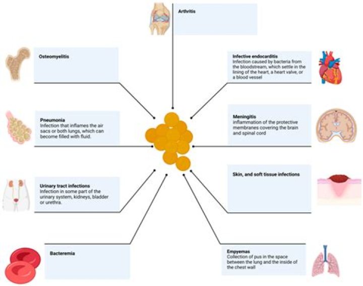 Will antibiotics help face swelling?