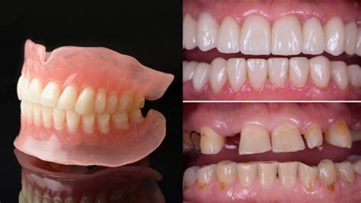 Will people be able to tell I have dentures?